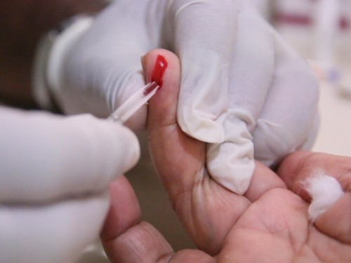 Dia Mundial contra a AIDS é lembrado em Fabriciano